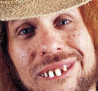 _gimages_HillbillyTeeth.jpg